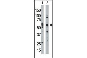 The anti-PRKR Pab (ABIN392779 and ABIN2837995) is used in Western blot to detect PRKR in mouse uterus tissue lysate (Lane 1) and HepG2 cell lysate (Lane 2).