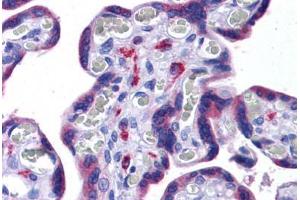 Human Placenta: Formalin-Fixed, Paraffin-Embedded (FFPE) (NLRC3 anticorps  (Internal Region))