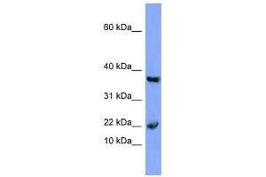 Myoglobin antibody used at 1 ug/ml to detect target protein. (Myoglobin anticorps  (N-Term))