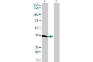Western Blot analysis of AKR1A1 expression in transfected 293T cell line by AKR1A1 monoclonal antibody (M01), clone 1A11-2A4.