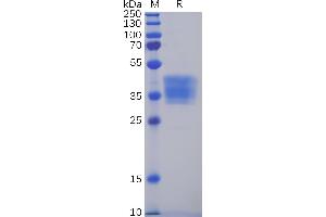 Human C Protein, mFc Tag on SDS-PAGE under reducing condition.