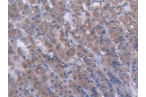 DAB staining on IHC-P; Samples: Rat Stomach Tissue (GCK anticorps  (AA 194-410))