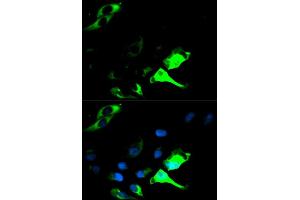 Immunofluorescence analysis of HeLa cell using KRT8 antibody. (KRT8 anticorps  (AA 1-483))
