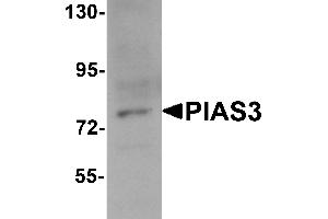 Western Blotting (WB) image for anti-Protein Inhibitor of Activated STAT, 3 (PIAS3) (C-Term) antibody (ABIN1030584) (PIAS3 anticorps  (C-Term))