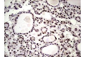 Image no. 15 for anti-Nibrin (NBN) (AA 183-460) antibody (ABIN1491058)