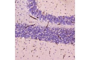IHC testing of FFPE human cerebellum tissue with C-Reactive Protein antibody at 2ug/ml. (CRP anticorps  (AA 20-230))