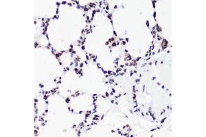 Immunohistochemistry of paraffin-embedded rat lung using H3K36me2 antibody.
