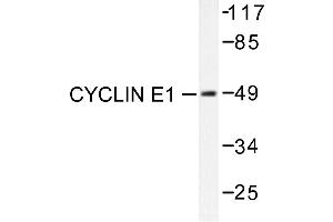 Image no. 1 for anti-Cyclin E1 (CCNE1) antibody (ABIN265380) (Cyclin E1 anticorps)