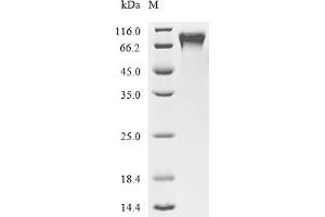 Coagulation Factor IX (F9) (AA 29-461), (full length) (Active) protein (His tag)