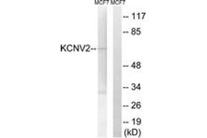 Western blot analysis of extracts from MCF-7 cells, using KCNV2 Antibody.