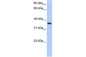 WB Suggested Anti-MAGEA4 Antibody Titration: 0. (MAGEA4 anticorps  (C-Term))