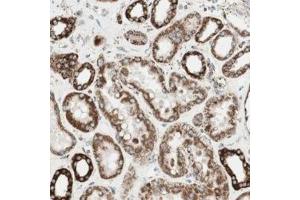Immunohistochemical staining of human kidney with TOMM22 polyclonal antibody  shows strong cytoplasmic positivity in renal tubules at 1:200-1:500 dilution. (TOMM22 anticorps)