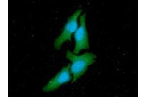 ICC/IF analysis of CSK in HeLa cells line, stained with DAPI (Blue) for nucleus staining and monoclonal anti-human CSK antibody (1:100) with goat anti-mouse IgG-Alexa fluor 488 conjugate (Green)