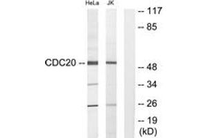 Western blot analysis of extracts from Jurkat/HeLa cells, using p55CDC Antibody.