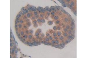 Figure. (DEFB126 anticorps  (AA 21-111))