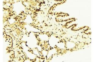 ABIN6277732 at 1/100 staining Mouse lung tissue by IHC-P.