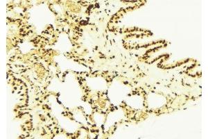 ABIN6277732 at 1/100 staining Mouse lung tissue by IHC-P. (NRF2 anticorps  (pSer40))