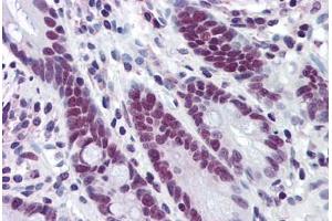 Human Small Intestine: Formalin-Fixed, Paraffin-Embedded (FFPE)