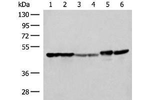 Western blot analysis of Hela A375 Human fetal liver tissue Human fetal brain tissue HepG2 cell and Mouse brain tissue lysates using FLOT2 Polyclonal Antibody at dilution of 1:350 (Flotillin 2 anticorps)