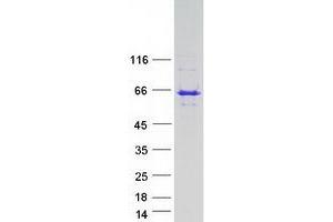 Validation with Western Blot