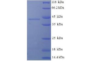 SDS-PAGE (SDS) image for Deoxyguanosine Kinase (DGUOK) (AA 40-277) protein (His-SUMO Tag) (ABIN5711305)