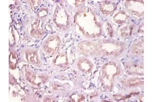 Immunohistochemistry of paraffin-embedded human kidney using DHRS9 antibody at dilution of 1:100. (DHRS9 anticorps  (HRP))
