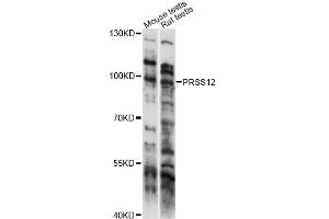 Western blot analysis of extracts of various cell lines, using PRSS12 antibody (ABIN6292705) at 1:1000 dilution. (Neurotrypsin anticorps)