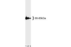 Western Blotting (WB) image for anti-MutL Homolog 1 (MLH1) antibody (ABIN967315) (MLH1 anticorps)