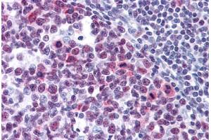 Human Tonsil: Formalin-Fixed, Paraffin-Embedded (FFPE)