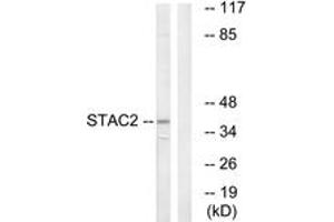Western blot analysis of extracts from K562 cells, using STAC2 Antibody. (STAC2 anticorps  (AA 211-260))