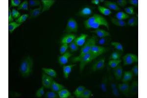 Immunofluorescence staining of Hela cells with ABIN7166575 at 1:133, counter-stained with DAPI. (Otopetrin 1 anticorps  (AA 414-544))