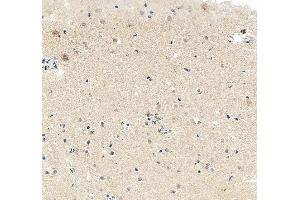 IHC analysis of MEF2C using anti-MEF2C antibody (ABIN6719606). (MEF2C anticorps)