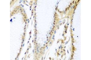 Immunohistochemistry of paraffin-embedded Human stomach using MYBBP1A Polyclonal Antibody at dilution of 1:100 (40x lens). (MYBBP1A anticorps)