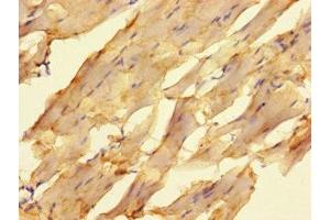Immunohistochemistry of paraffin-embedded human skeletal muscle tissue using ABIN7176667 at dilution of 1:100 (ELAC1 anticorps  (AA 1-363))