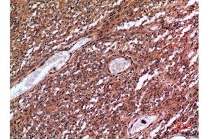Immunohistochemistry (IHC) analysis of paraffin-embedded Human Brain, antibody was diluted at 1:100. (MME anticorps  (Internal Region))