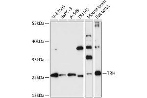TRH anticorps  (AA 100-200)