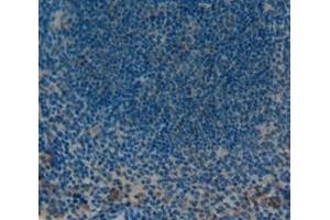 Used in DAB staining on fromalin fixed paraffin- embedded Kidney tissue