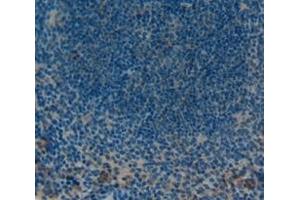 Used in DAB staining on fromalin fixed paraffin- embedded Kidney tissue (PTPRH anticorps  (AA 685-909))