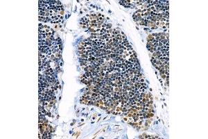 Immunohistochemistry of paraffin embedded rat thymus using Skar (ABIN7074970) at dilution of 1:900 (400x lens) (p46 anticorps)