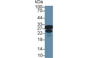 Western Blot; Sample: Mouse Spleen lysate; Primary Ab: 2µg/ml Rabbit Anti-Rat CA2 Antibody Second Ab: 0.