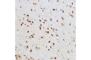 Immunohistochemistry of paraffin-embedded mouse brain using KLF12 antibody (ABIN7268152) at dilution of 1:100 (40x lens). (KLF12 anticorps)
