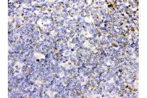 CD27 was detected in paraffin-embedded sections of human tonsil tissues using rabbit anti- CD27 Antigen Affinity purified polyclonal antibody (Catalog # ) at 1 µg/mL.