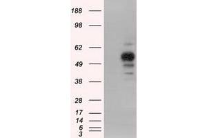 HEK293T cells were transfected with the pCMV6-ENTRY control (Left lane) or pCMV6-ENTRY PRKAR2A (Right lane) cDNA for 48 hrs and lysed.
