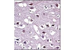 Immunohistochemistry analysis in formalin fixed and paraffin embedded human brain tissue reacted with OPRM1 Antibody (Center) followed which was peroxidase conjugated to the secondary antibody and followed by DAB staining.