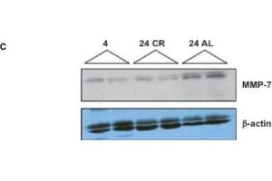 Age-dependent changes in MMP/TIMP expression in the kidney.
