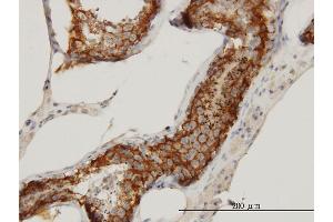 Immunoperoxidase of monoclonal antibody to FATE1 on formalin-fixed paraffin-embedded human testis.