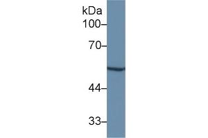 Detection of MMP12 in Rat Liver lysate using Polyclonal Antibody to Matrix Metalloproteinase 12 (MMP12)