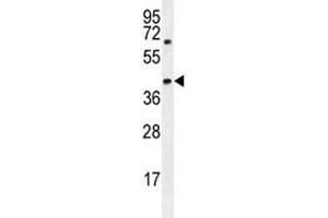 AMACR antibody western blot analysis in MDA-MB231 lysate