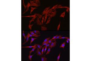 Immunofluorescence analysis of A-549 cells using TMPRSS2 Rabbit pAb (ABIN6132728, ABIN6149286, ABIN6149287 and ABIN6219138) at dilution of 1:50 (40x lens). (TMPRSS2 anticorps  (AA 140-400))