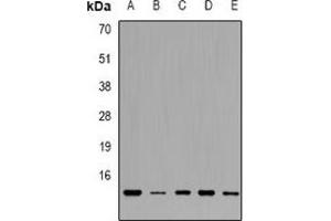 Western blot analysis of TRP14 expression in HL60 (A), Raji (B), K562 (C), SW480 (D), A549 (E) whole cell lysates. (TXNDC17 anticorps)